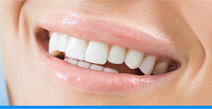 A close up of a woman's teeth