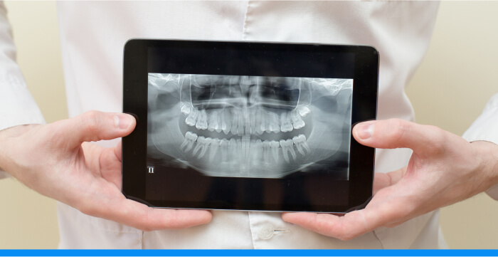 A man's hands holding a computer tablet showing a full-mouth x-ray image